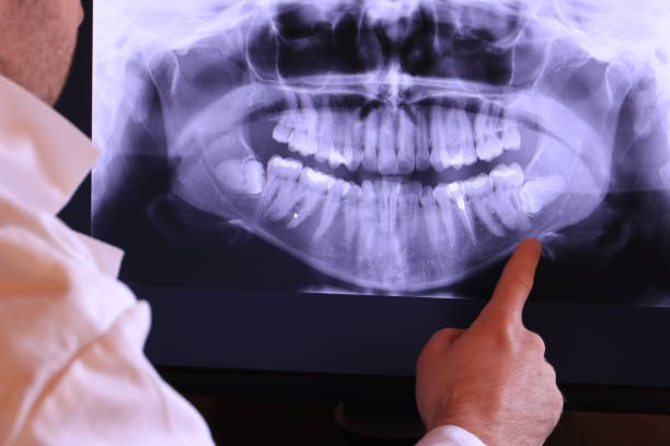 Best Emergency Broken Tooth Repair in Delta, OH