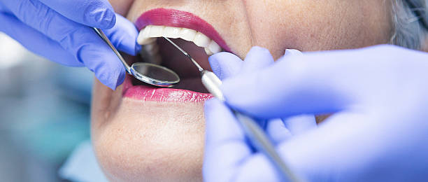 Best Emergency Tooth Extraction in Delta, OH